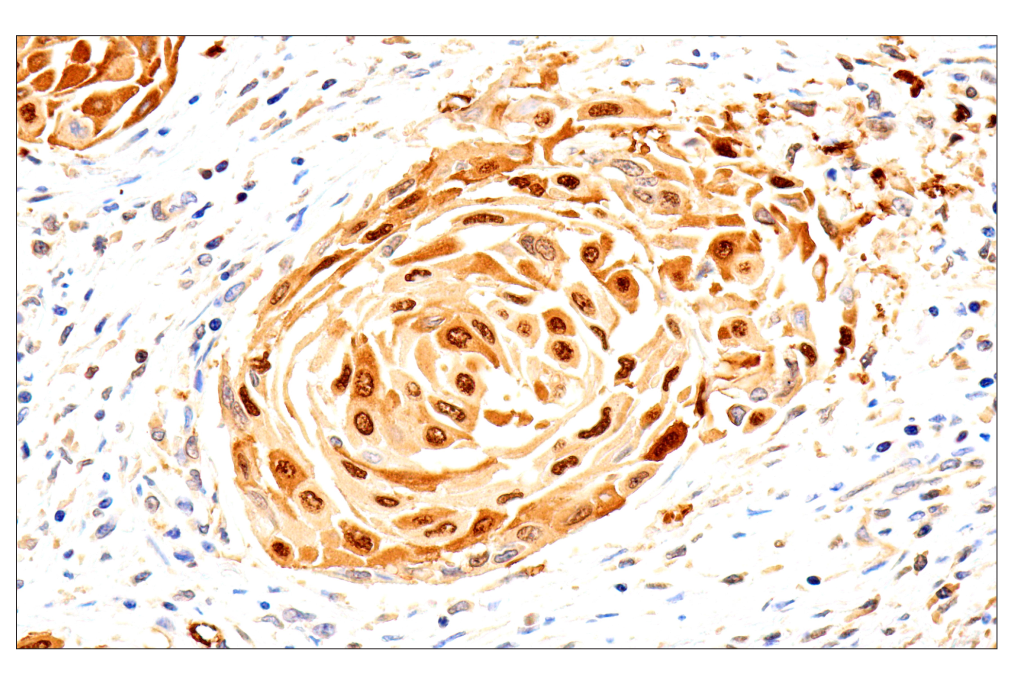 Immunohistochemistry Image 2: SERPINB3 (OTI1A12) Mouse mAb