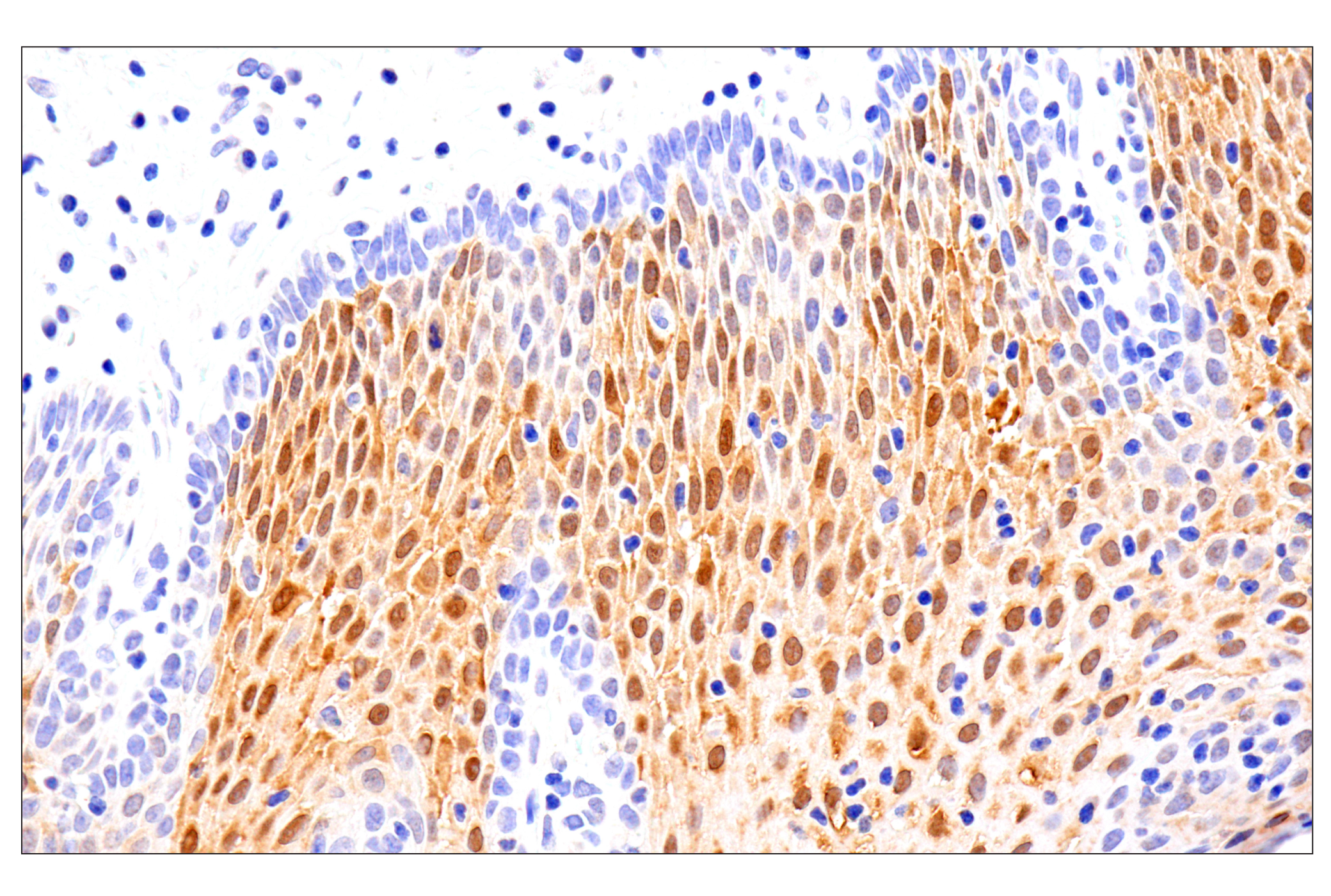 Immunohistochemistry Image 5: SERPINB3 (OTI1A12) Mouse mAb
