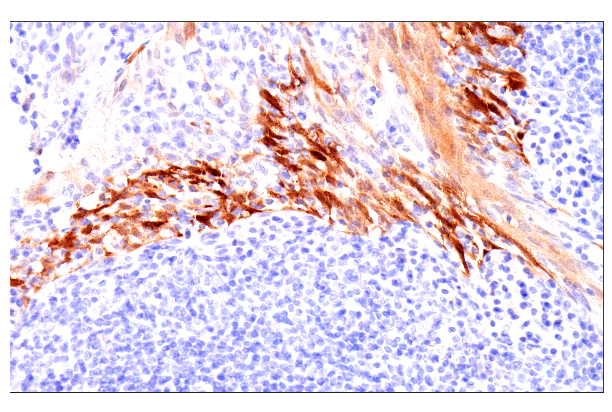 Immunohistochemistry Image 6: SERPINB3 (OTI1A12) Mouse mAb