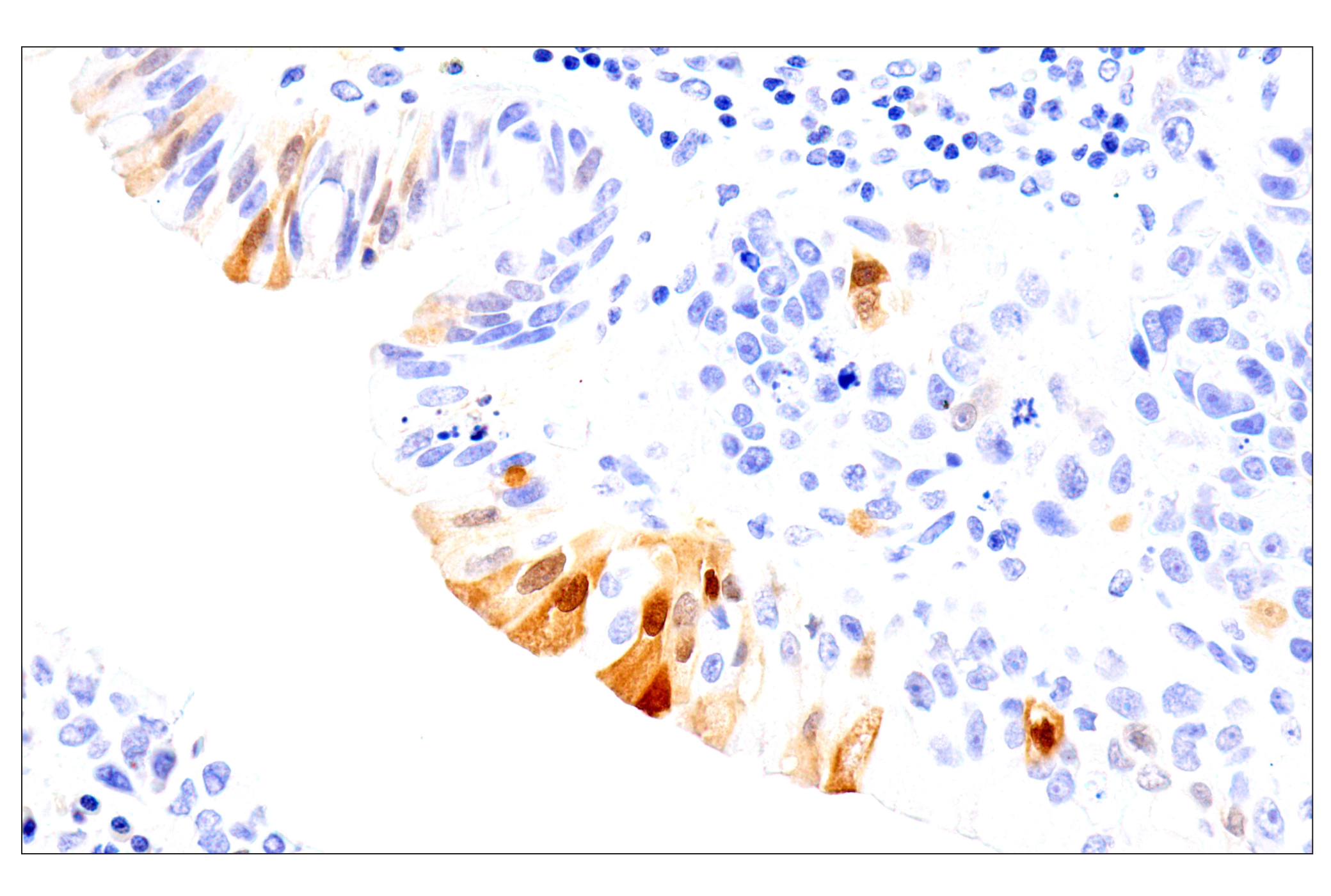 Immunohistochemistry Image 4: SERPINB3 (OTI1A12) Mouse mAb