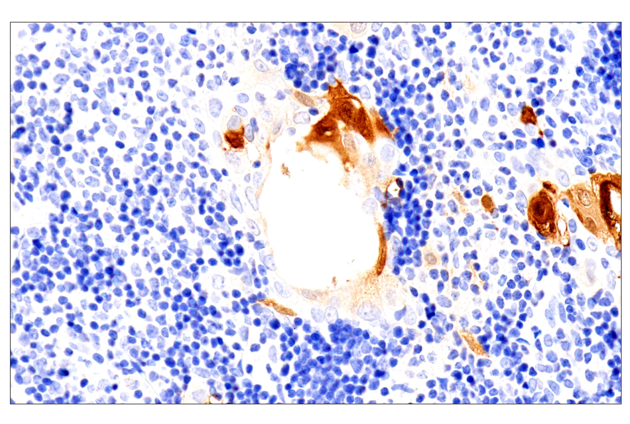 Immunohistochemistry Image 7: SERPINB3 (OTI1A12) Mouse mAb