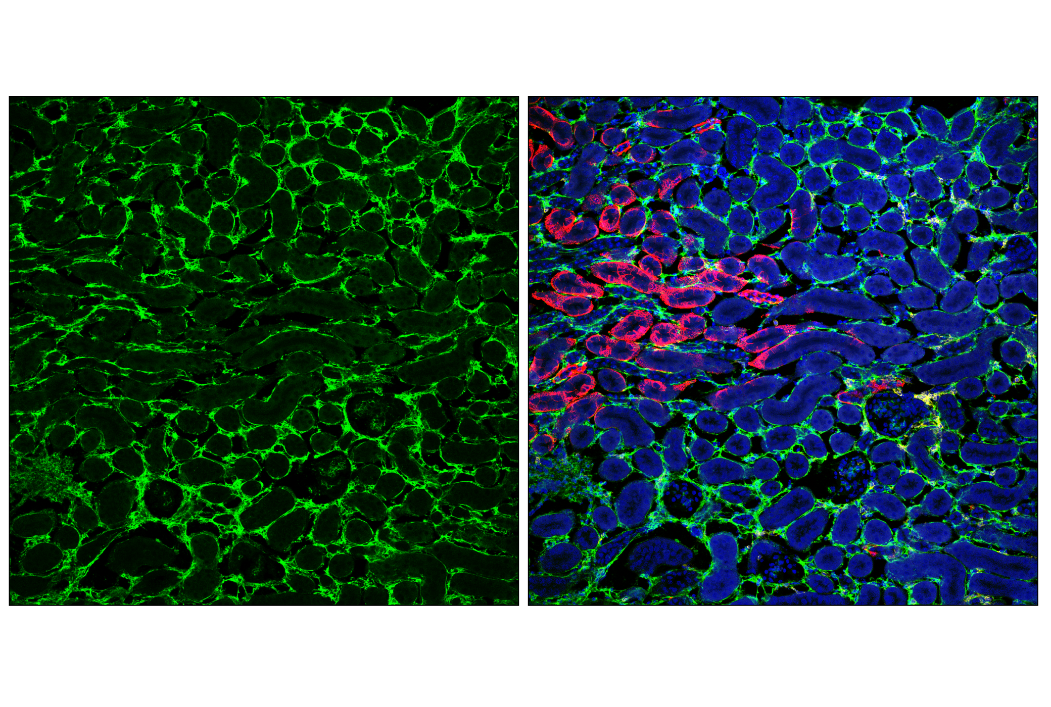 Immunofluorescence Image 3: COL6A1 (E9U3B) Rabbit mAb