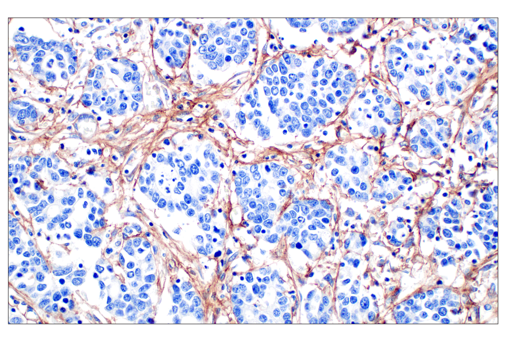 Immunohistochemistry Image 1: COL6A1 (E9U3B) Rabbit mAb