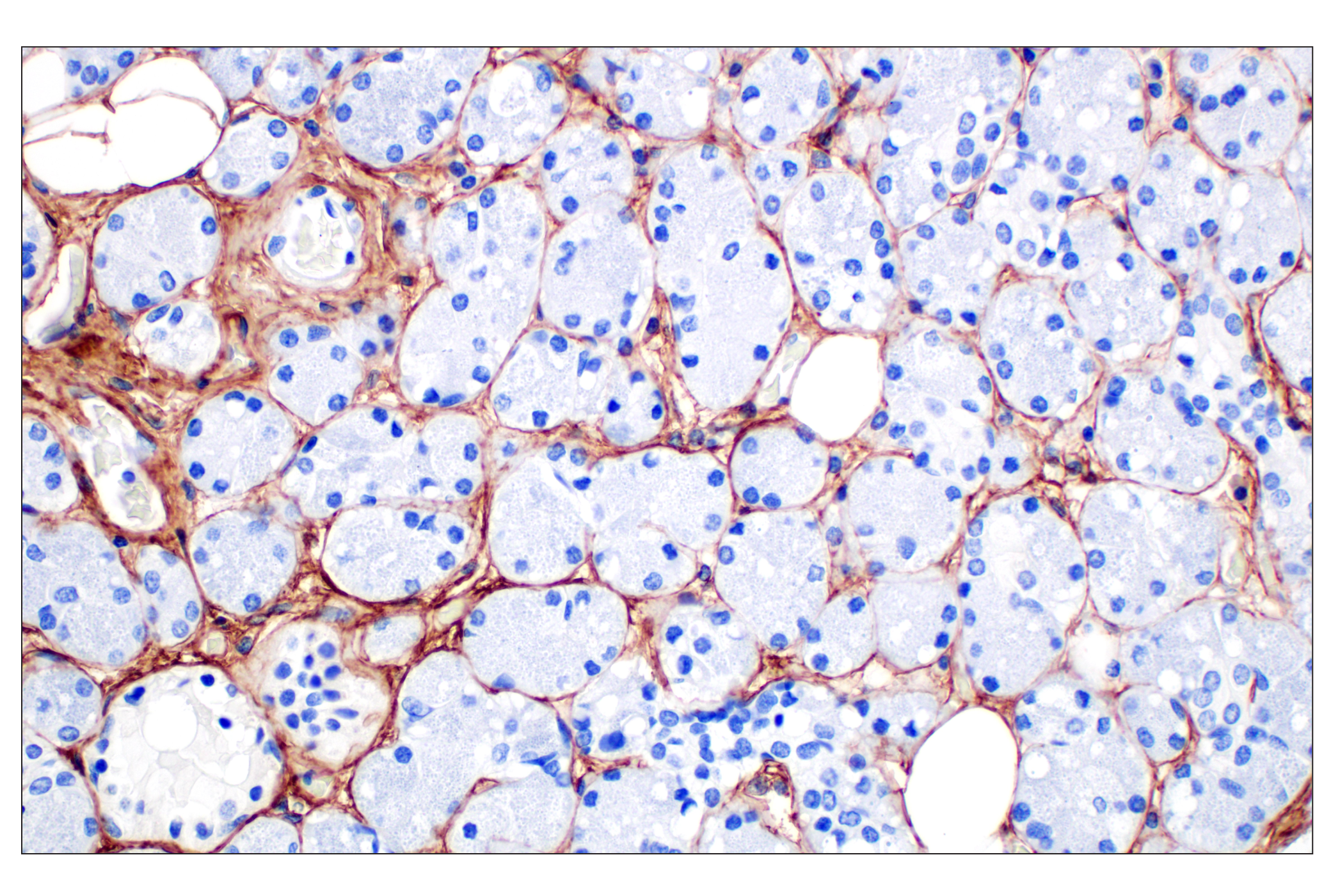 Immunohistochemistry Image 2: COL6A1 (E9U3B) Rabbit mAb