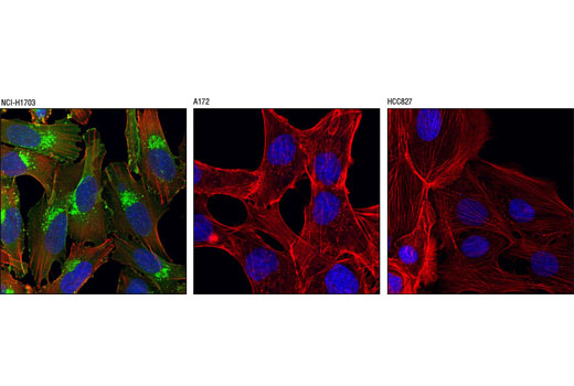 Immunofluorescence Image 1: PDGF Receptor α (D13C6) XP® Rabbit mAb