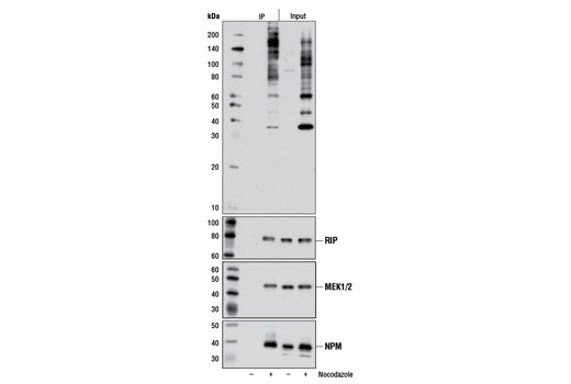 Immunoprecipitation Image 1: Phospho-PLK Binding Motif (ST*P) (D73F6) Rabbit mAb