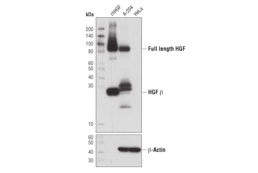  Image 7: Cancer-associated Growth Factor Antibody Sampler Kit