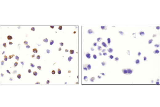 Immunohistochemistry Image 2: HGF β (D6S7D) XP® Rabbit mAb