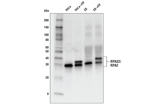Western Blotting Image 1: RPA32/RPA2 Antibody
