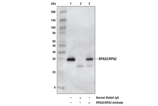 Immunoprecipitation Image 1: RPA32/RPA2 Antibody