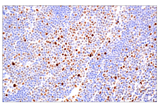  Image 16: Polycomb Group 2 (PRC2) Antibody Sampler Kit