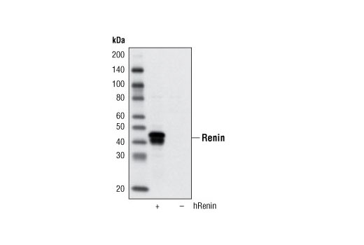 Western Blotting Image 1: Renin Antibody