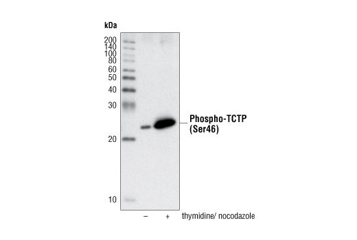 Western Blotting Image 1: Phospho-TCTP (Ser46) Antibody