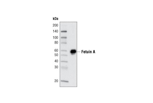 Western Blotting Image 1: Fetuin A (F180) Antibody