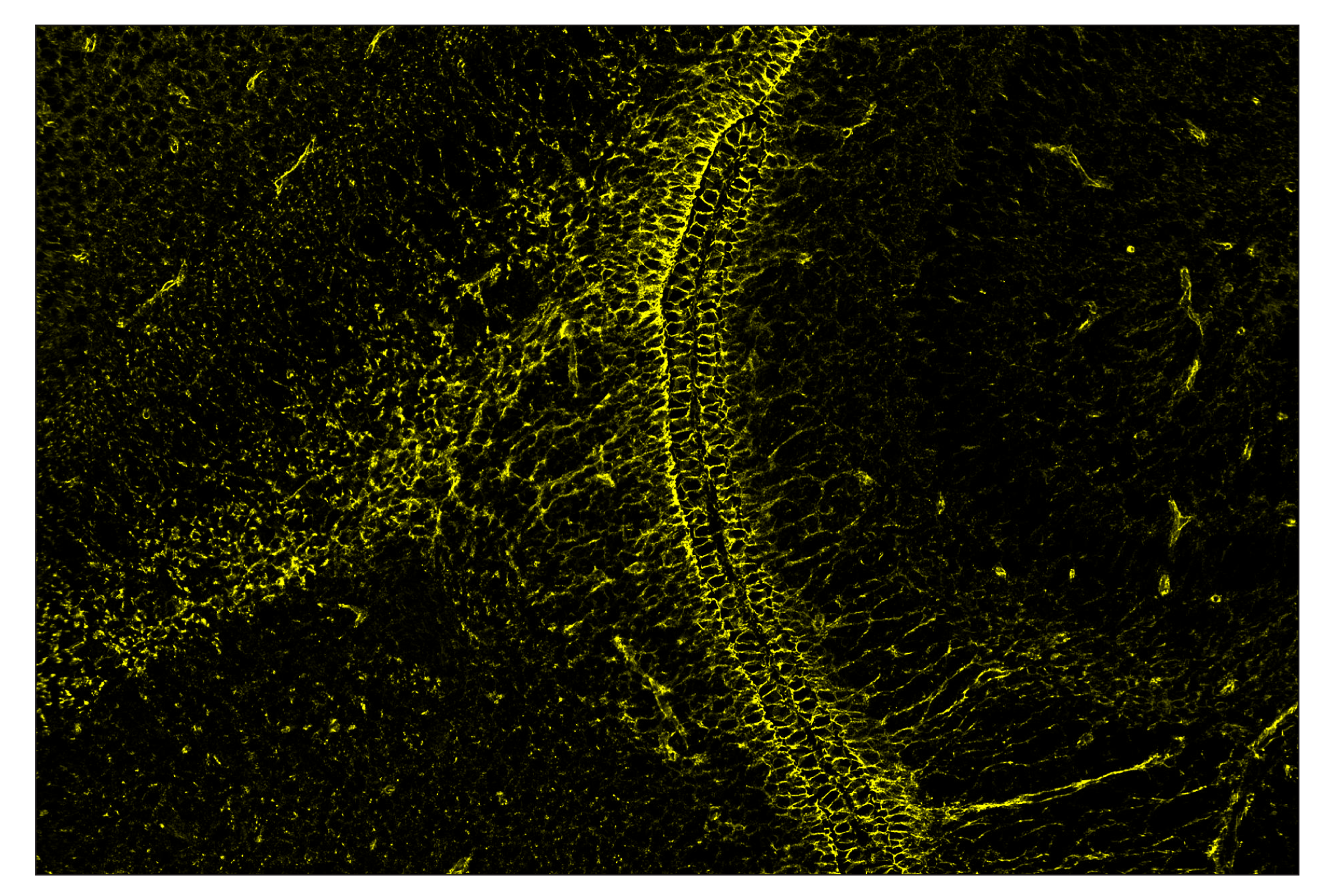 Immunohistochemistry Image 2: β-Catenin (D10A8) & CO-0108-594 SignalStar™ Oligo-Antibody Pair