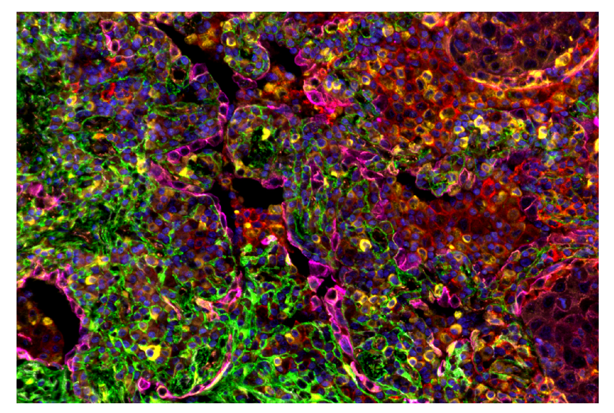Immunohistochemistry Image 6: β-Catenin (D10A8) & CO-0108-594 SignalStar™ Oligo-Antibody Pair