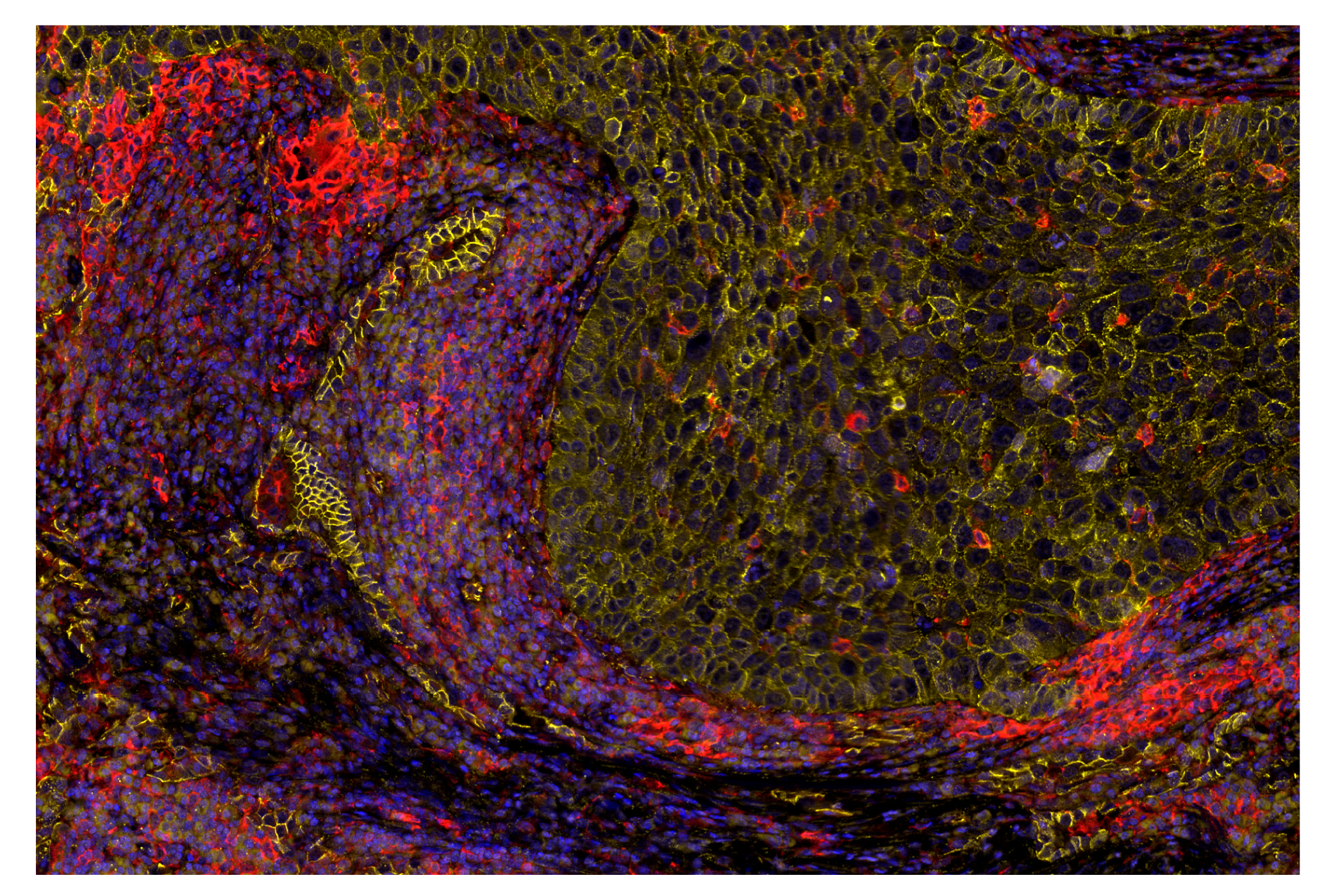 Immunohistochemistry Image 8: β-Catenin (D10A8) & CO-0108-594 SignalStar™ Oligo-Antibody Pair