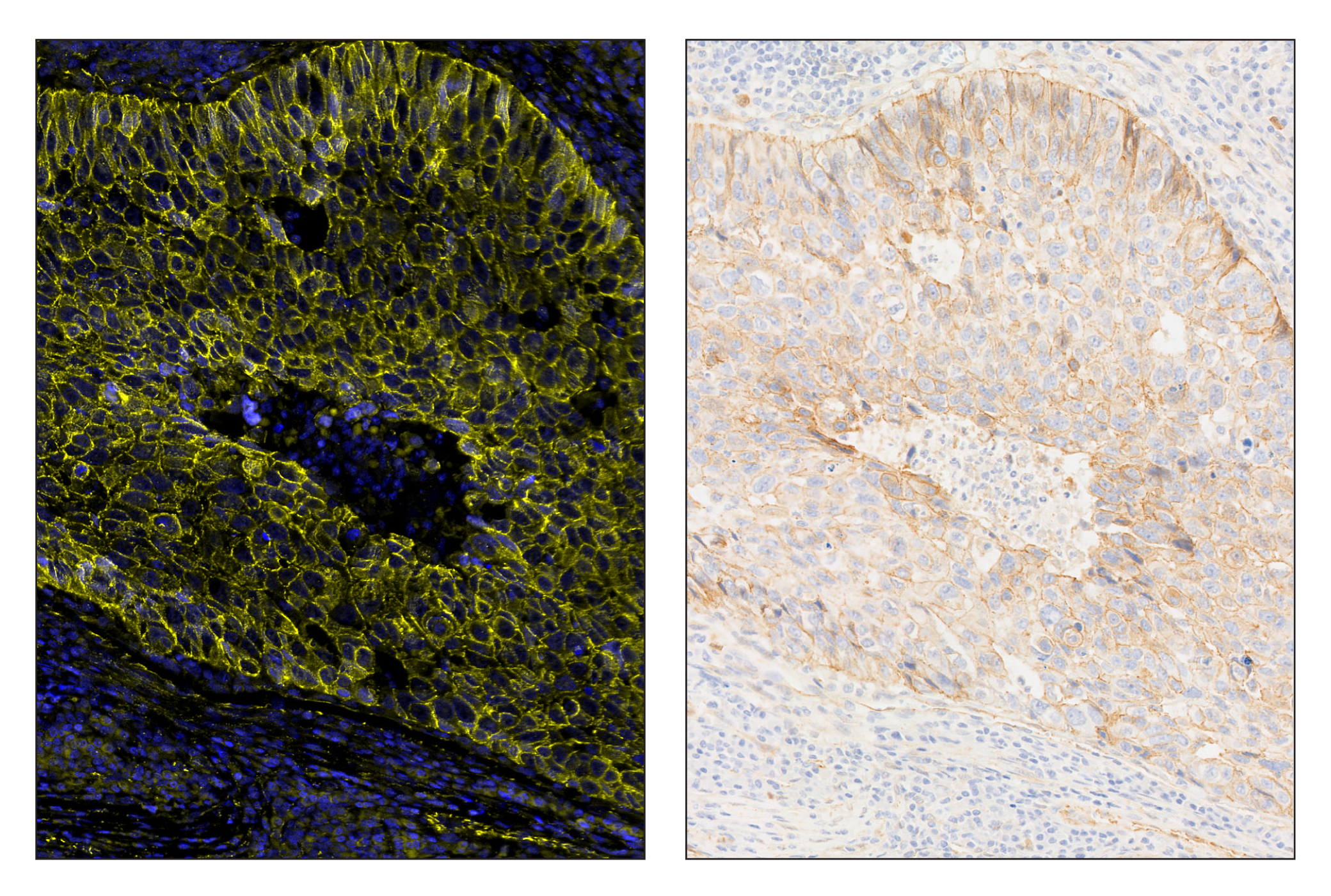 Immunohistochemistry Image 5: β-Catenin (D10A8) & CO-0108-594 SignalStar™ Oligo-Antibody Pair
