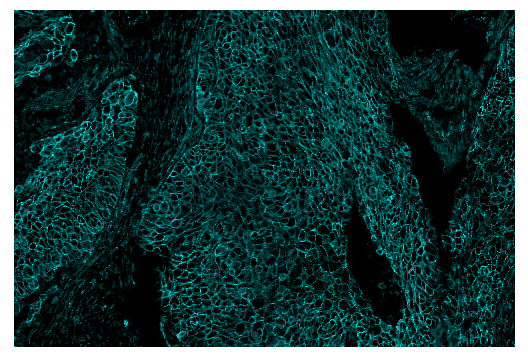 Immunohistochemistry Image 4: β-Catenin (D10A8) & CO-0108-594 SignalStar™ Oligo-Antibody Pair
