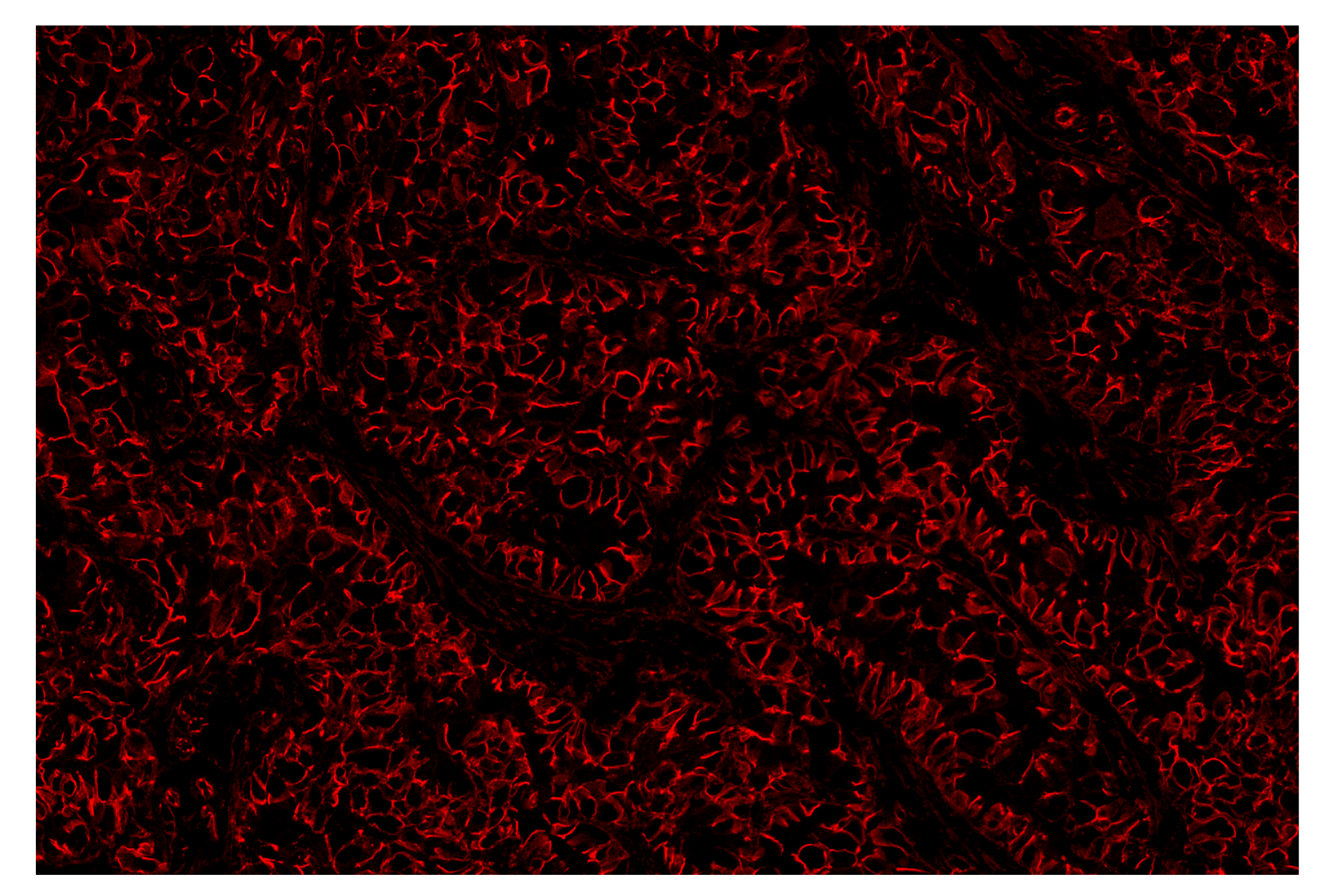 Immunohistochemistry Image 3: β-Catenin (D10A8) & CO-0108-594 SignalStar™ Oligo-Antibody Pair