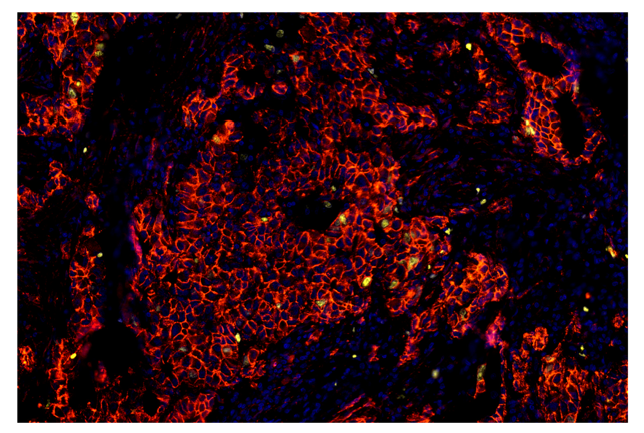 Immunohistochemistry Image 7: β-Catenin (D10A8) & CO-0108-594 SignalStar™ Oligo-Antibody Pair