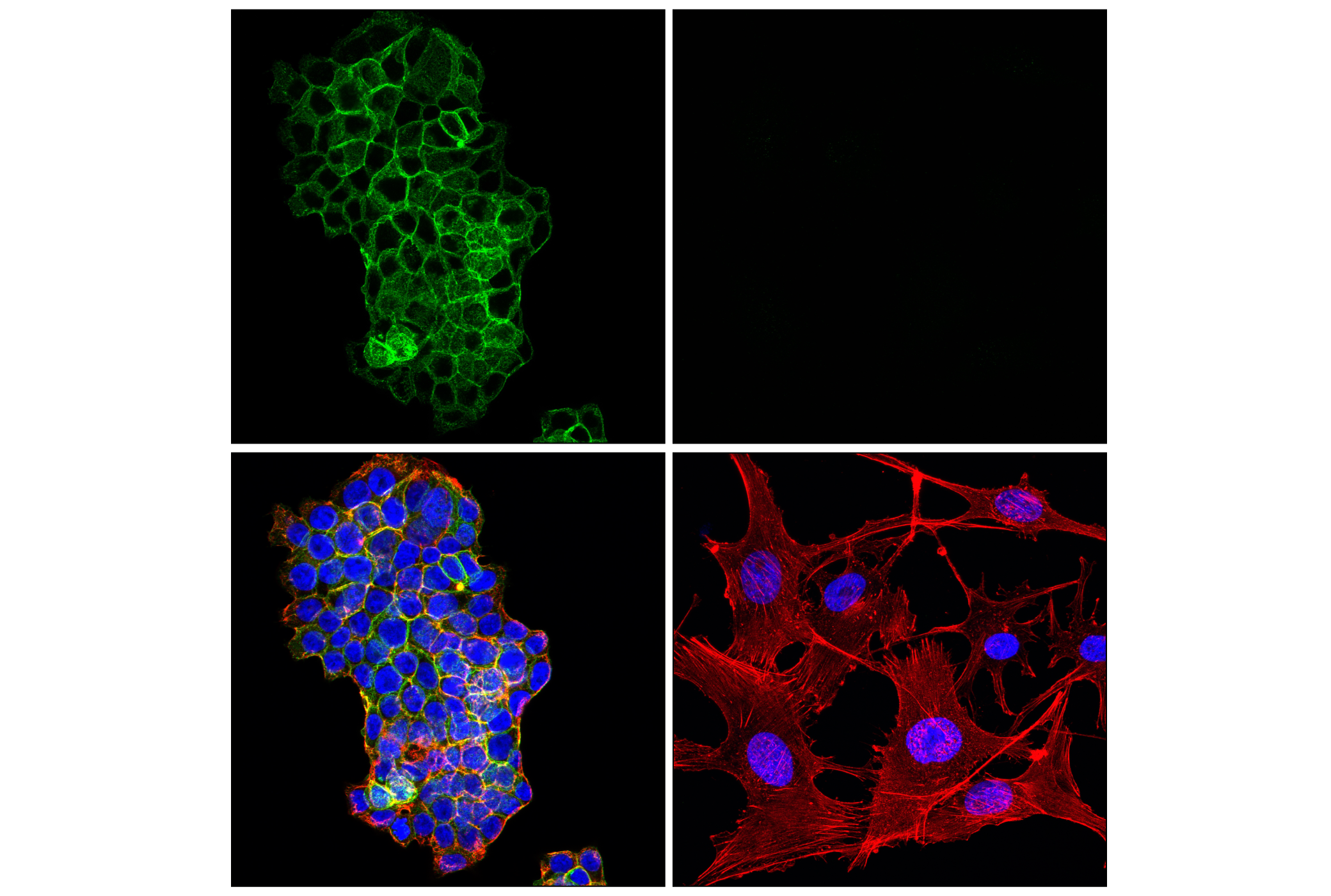 Immunofluorescence Image 4: SNAP25 (F5Z2D) Rabbit mAb