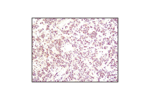 Immunohistochemistry Image 1: p35/25 (C64B10) Rabbit mAb (BSA and Azide Free)