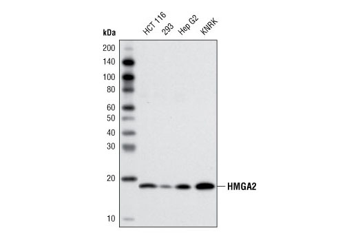 Western Blotting Image 1: HMGA2 Antibody