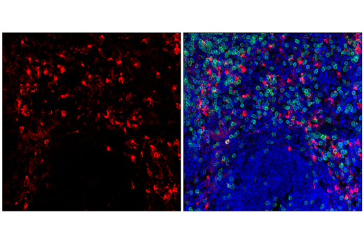 Immunofluorescence Image 1: TIM-3 (E9K5D) Rabbit mAb (Alexa Fluor® 555 Conjugate)