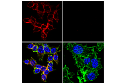 Immunofluorescence Image 3: TIM-3 (E9K5D) Rabbit mAb (Alexa Fluor® 555 Conjugate)