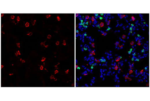 Immunofluorescence Image 2: TIM-3 (E9K5D) Rabbit mAb (Alexa Fluor® 555 Conjugate)