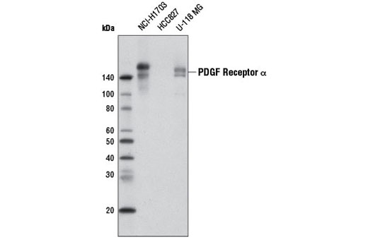 Western Blotting Image 1: PDGF Receptor α (D13C6) XP® Rabbit mAb (Biotinylated)