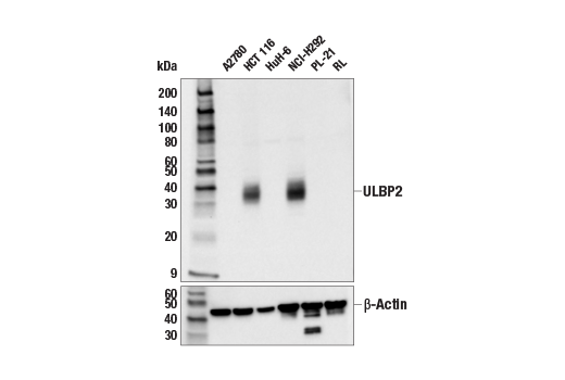 Western Blotting Image 1: ULBP2 (E9G2P) Rabbit mAb