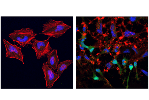 Immunofluorescence Image 1: Cleaved Caspase-9 (Asp330) (E5Z7N) Rabbit mAb