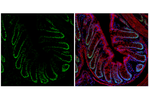 Immunofluorescence Image 1: NSUN2 (E9Y5E) Rabbit mAb