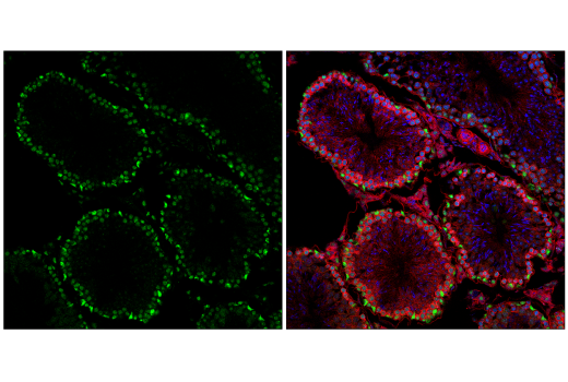 Immunofluorescence Image 2: NSUN2 (E9Y5E) Rabbit mAb