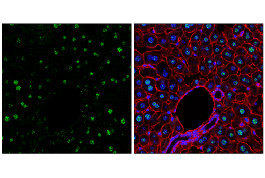 Immunofluorescence Image 3: NSUN2 (E9Y5E) Rabbit mAb