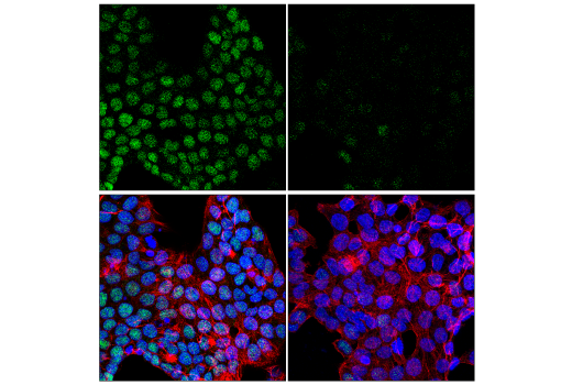 Immunofluorescence Image 5: NSUN2 (E9Y5E) Rabbit mAb