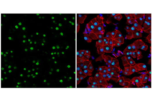 Immunofluorescence Image 4: NSUN2 (E9Y5E) Rabbit mAb