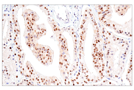 Immunohistochemistry Image 3: NSUN2 (E9Y5E) Rabbit mAb