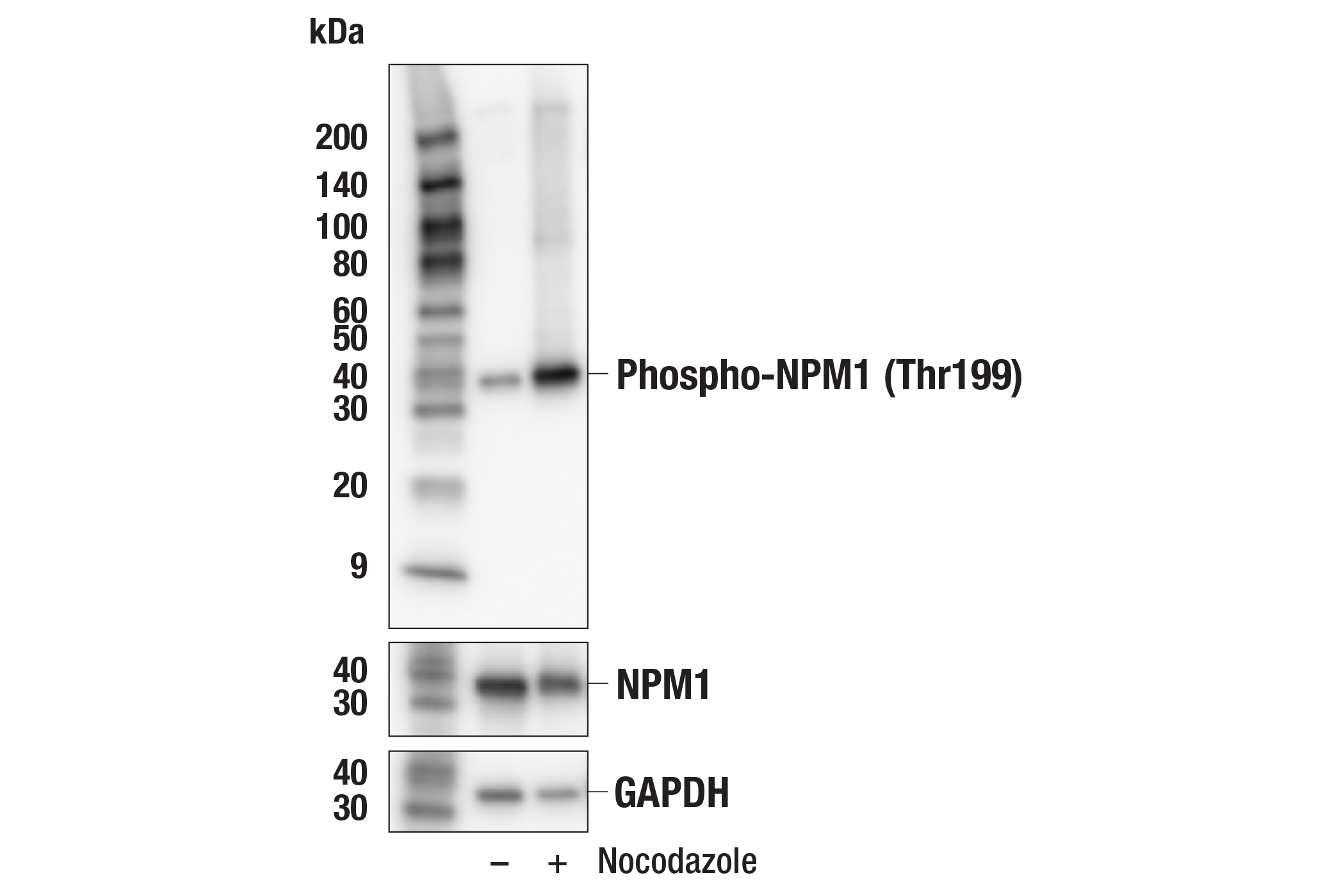 Western Blotting Image 3: Phospho-NPM1 (Thr199) (E4C7S) Rabbit mAb (BSA and Azide Free)