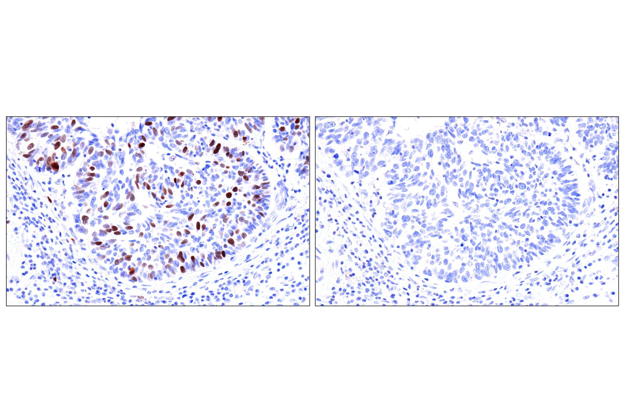 Immunohistochemistry Image 15: Phospho-NPM1 (Thr199) (E4C7S) Rabbit mAb (BSA and Azide Free)