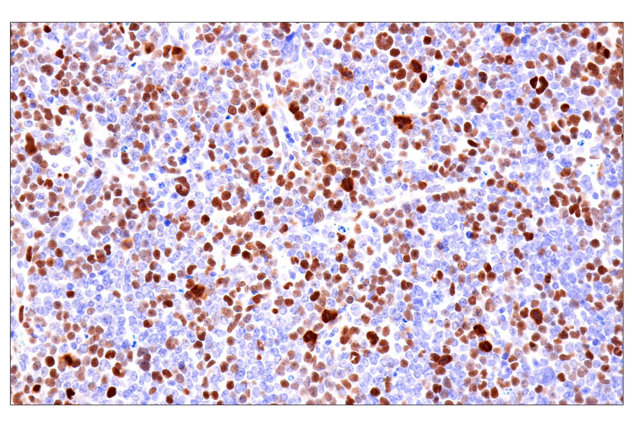 Immunohistochemistry Image 11: Phospho-NPM1 (Thr199) (E4C7S) Rabbit mAb (BSA and Azide Free)
