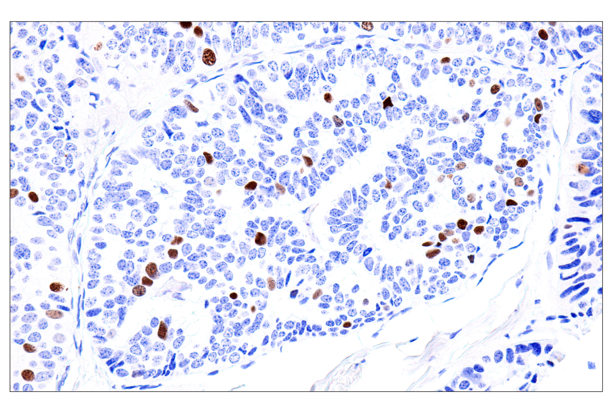 Immunohistochemistry Image 1: Phospho-NPM1 (Thr199) (E4C7S) Rabbit mAb (BSA and Azide Free)