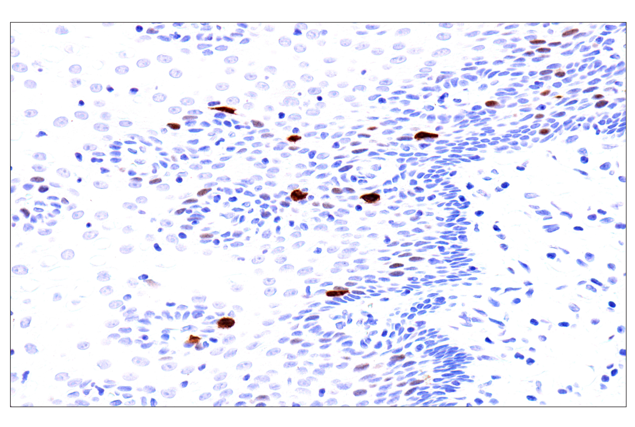 Immunohistochemistry Image 10: Phospho-NPM1 (Thr199) (E4C7S) Rabbit mAb (BSA and Azide Free)