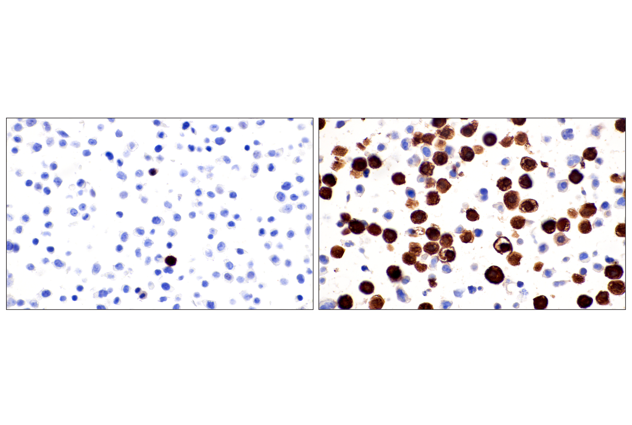 Immunohistochemistry Image 17: Phospho-NPM1 (Thr199) (E4C7S) Rabbit mAb (BSA and Azide Free)