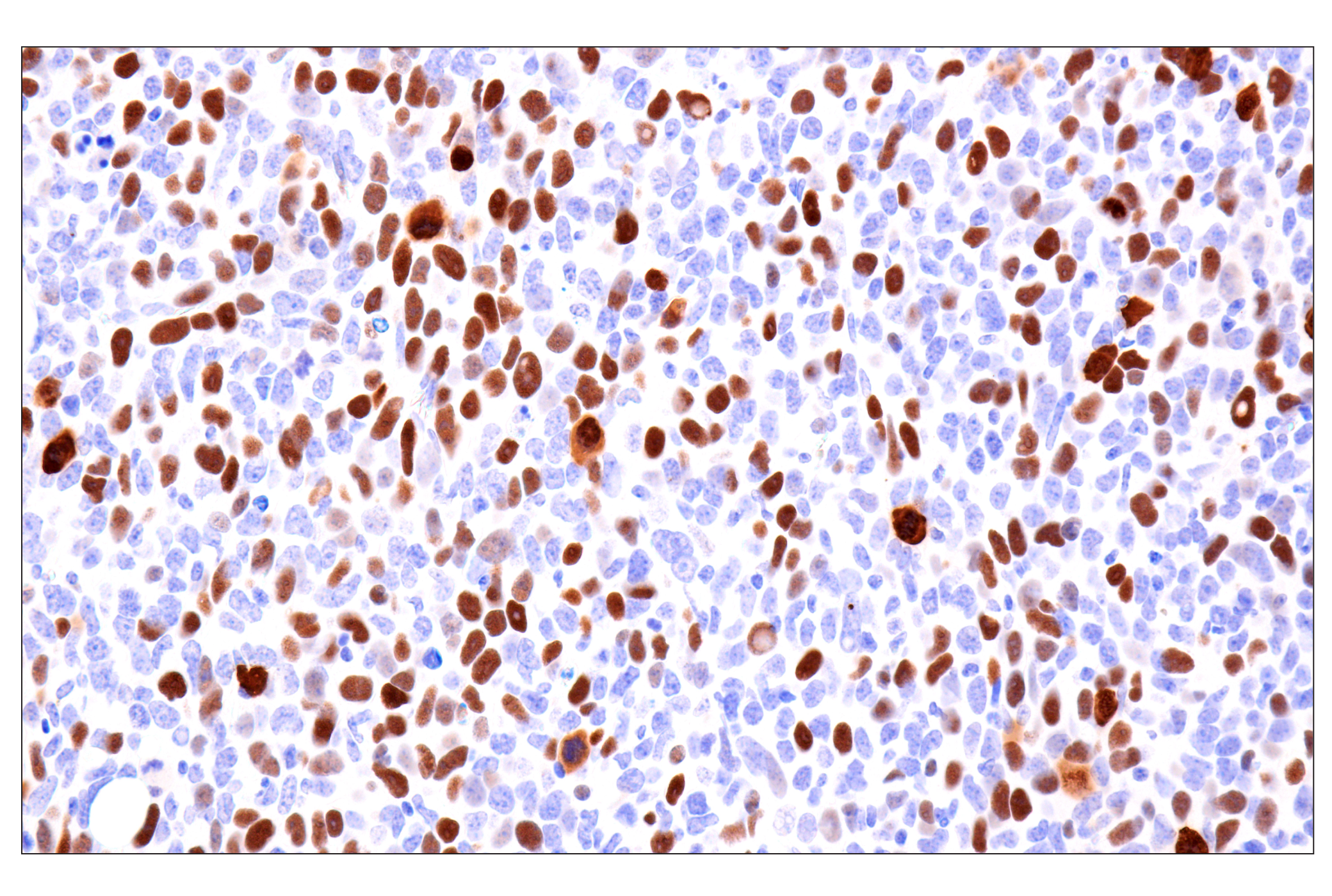 Immunohistochemistry Image 12: Phospho-NPM1 (Thr199) (E4C7S) Rabbit mAb (BSA and Azide Free)