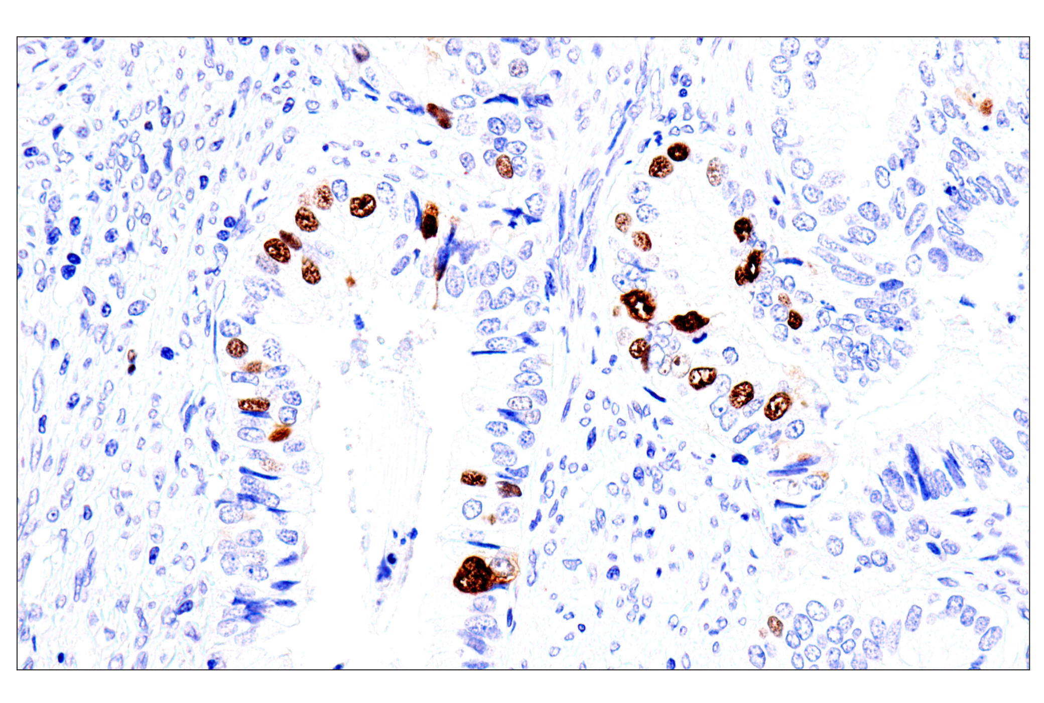 Immunohistochemistry Image 2: Phospho-NPM1 (Thr199) (E4C7S) Rabbit mAb (BSA and Azide Free)