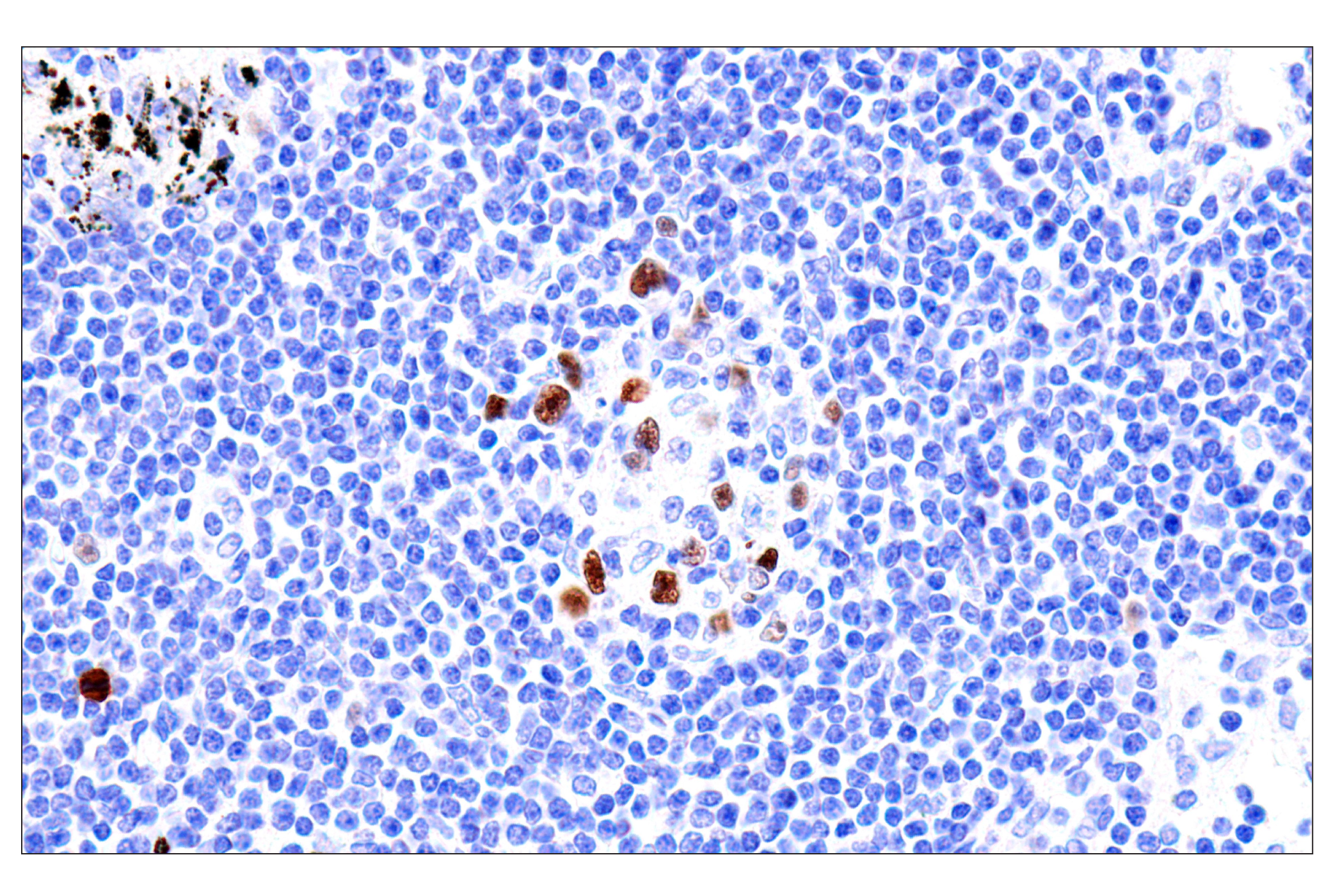 Immunohistochemistry Image 9: Phospho-NPM1 (Thr199) (E4C7S) Rabbit mAb (BSA and Azide Free)