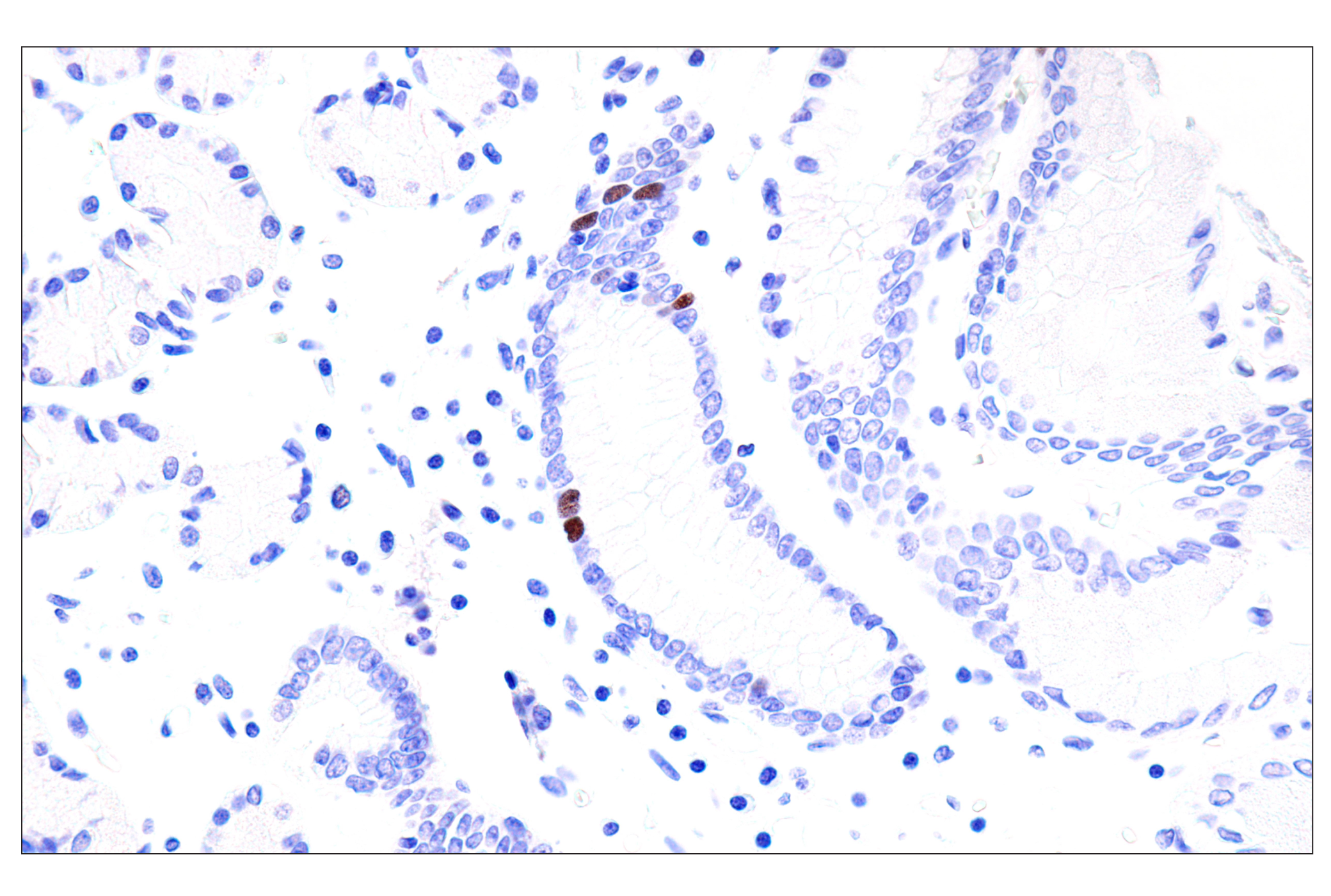 Immunohistochemistry Image 8: Phospho-NPM1 (Thr199) (E4C7S) Rabbit mAb (BSA and Azide Free)